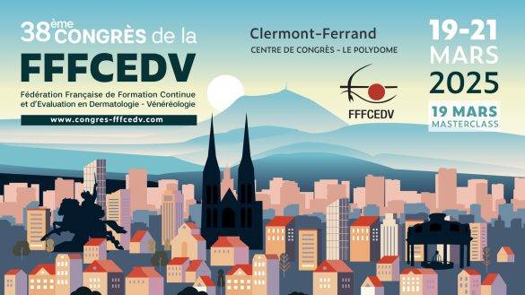 DIA-FFFCEDV-20251-585x329
